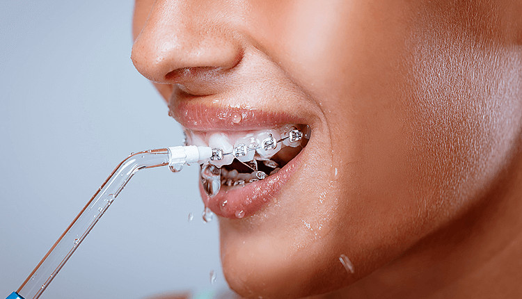 Máy tăm nước có thể thay thế bàn chải đánh răng được không