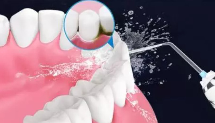 Máy tăm nước giúp làm sạch mọi mảng bám ở kẻ răng